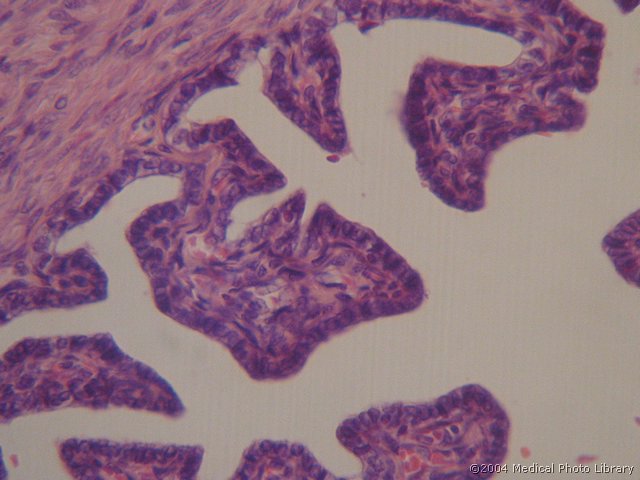 011 12 Tuba uterina.jpg