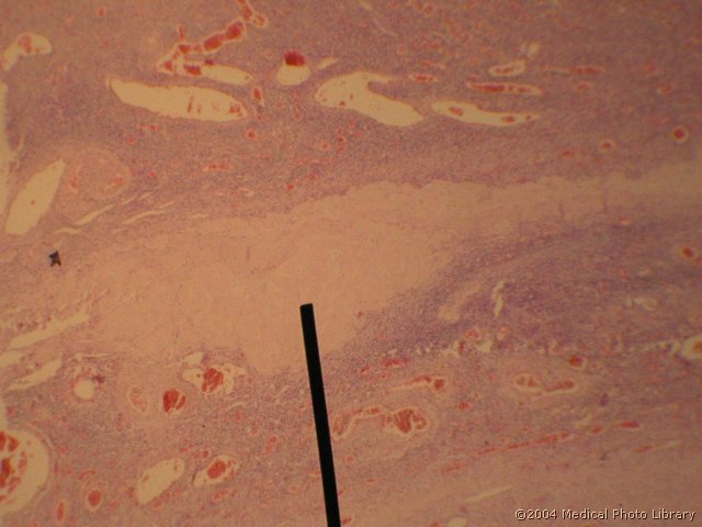 128 05 Belo telesce.jpg