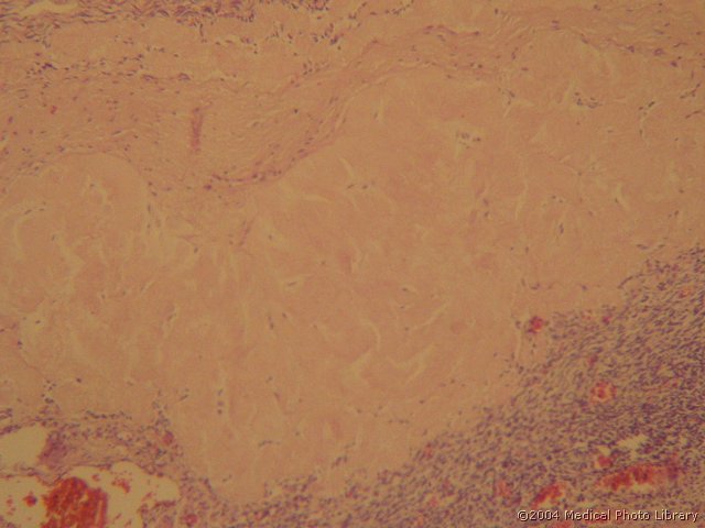 128 06 Belo telesce.jpg