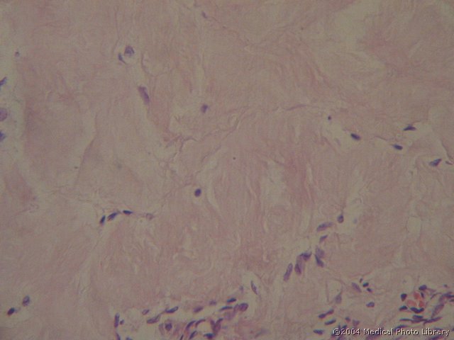 128 07 Belo telesce.jpg