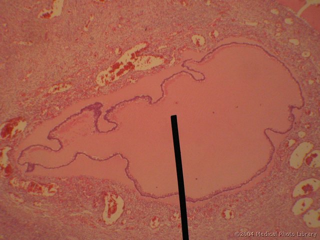 128 08 Atreticni f.jpg