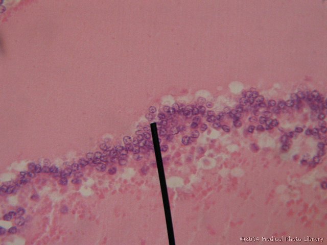 128 10 Atreticni f.jpg