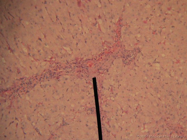 130 03 Celice teke.jpg