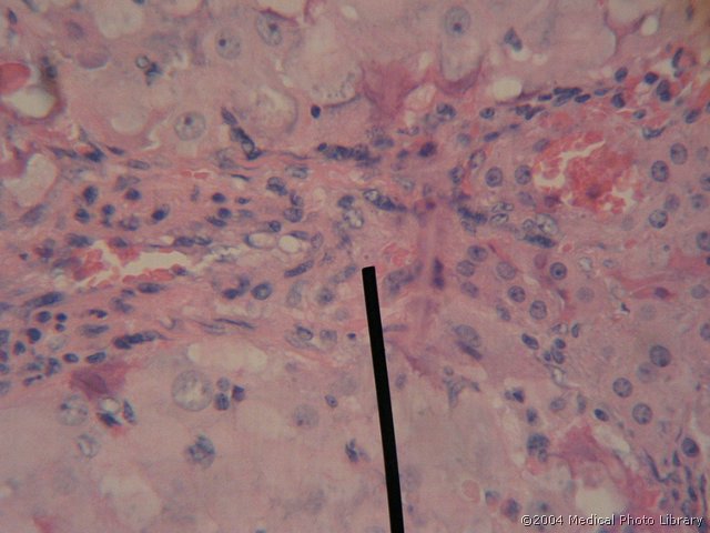 130 04 Celice teke.jpg