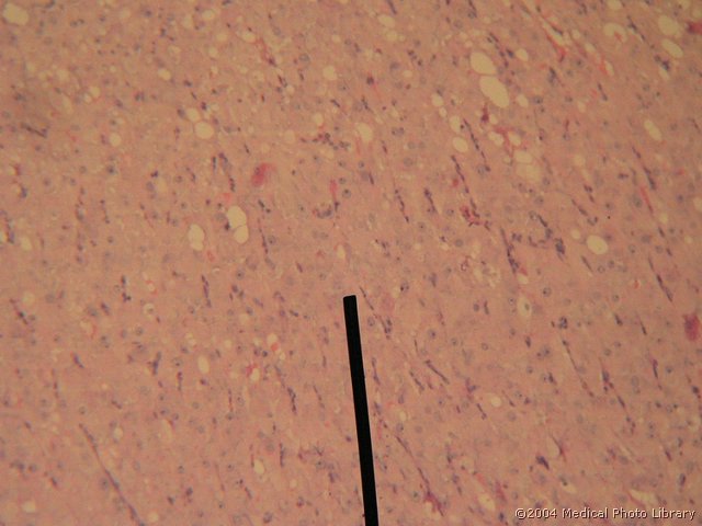 130 05 Celice granuloze.jpg