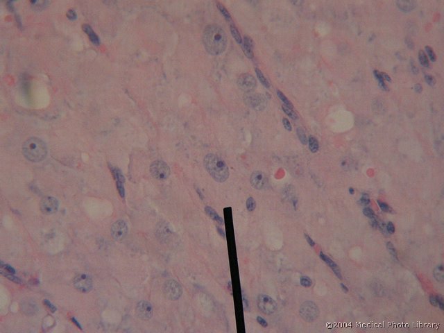 130 06 Celice granuloze.jpg