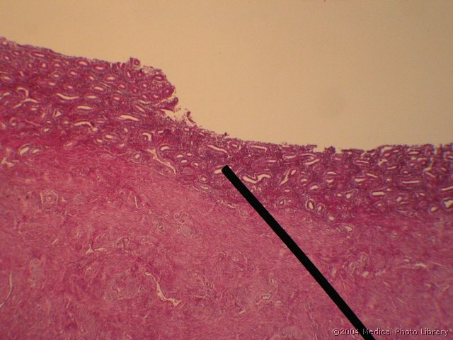 131 04 Endometrij.jpg