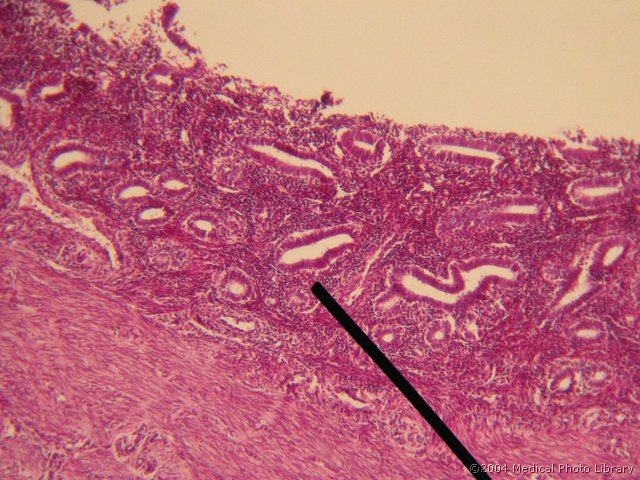 131 05 Endometrij.jpg