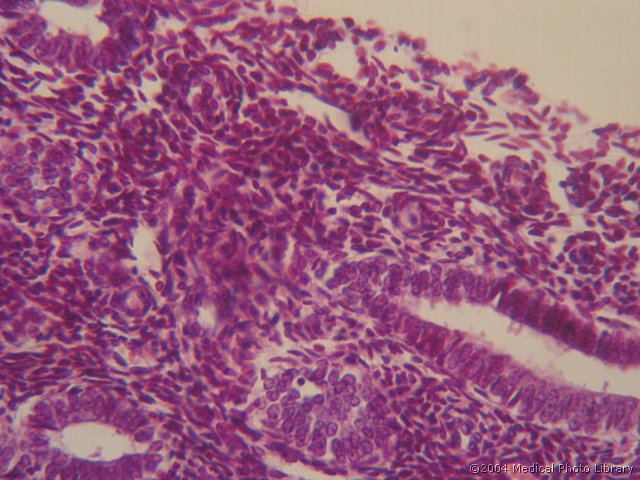 131 06 Endometrij.jpg