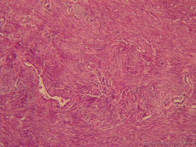 131 07 Miometrij.jpg