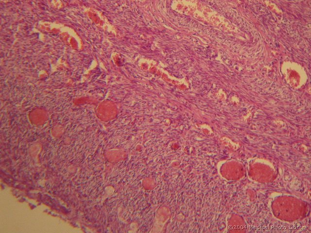 131 08 Perimetrij.jpg