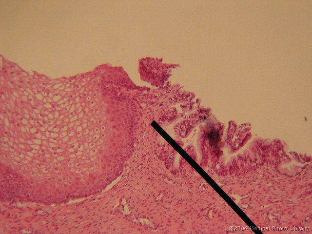 133 04 Prehod epitelija.jpg