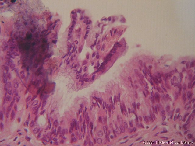 133 05 Enosk. visprizm.jpg