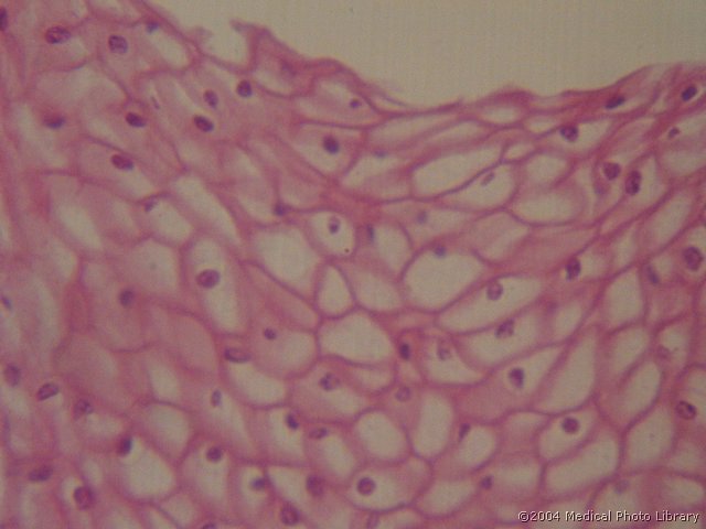 133 06 Vecskl. ploscati.jpg