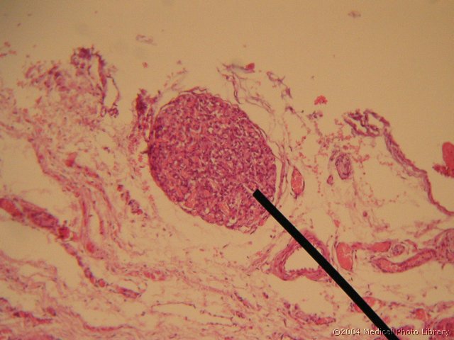 134 02 Zivcni koncic.jpg