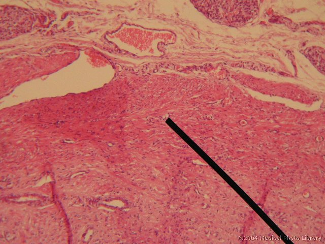 134 05 Misicnina.jpg