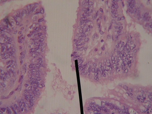 159 5 Klinasta celica.jpg