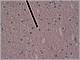 052 12 Oligodendocit.jpg