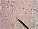 052 06 Astrocit.JPG
